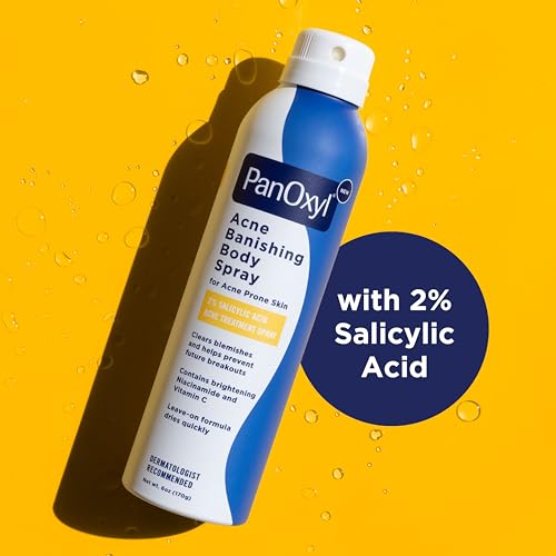 PanOxyl Acne Banishing Body Spray with 2% Salicylic Acid, Pimple Treatment Spray to Clear Stubborn Breakouts, 360-Degree Spray Nozzle, Skin-Brightening Niacinamide, Vitamin C, Witch Hazel, Aloe, 6 Oz