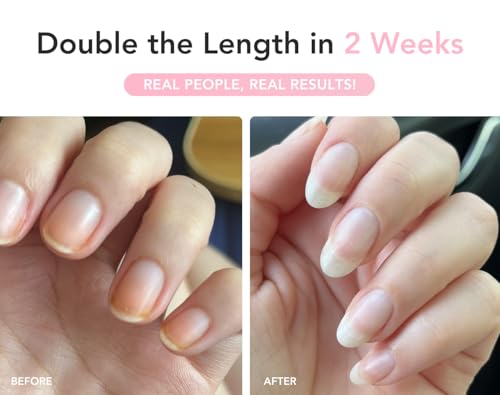 Liaison UltraGrow Nail Growth & Strength Serum with Keratin & Vitamin E