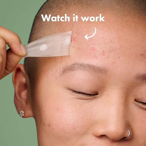 Mighty Patch Surface Large Acne Patches, 10 Count Hydrocolloid Strips
