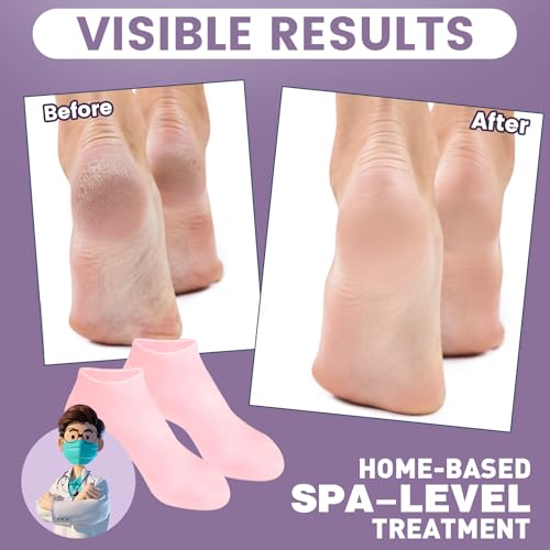 TEAWOO Silicone Moisturizing Heel Socks for Cracked Feet Care