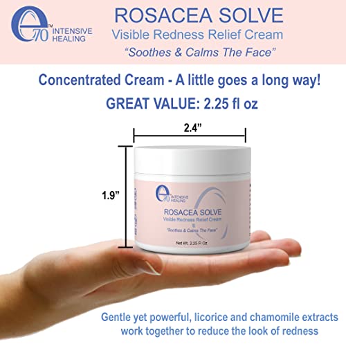 e70 Rosacea Solve - Redness Relief Cream - Face Moisturizer For Rosacea & Acne Prone Skin - Sensitive Skin Care With Organic Ingredients, Almond Oil, Licorice & Chamomile Extracts - No Parabens