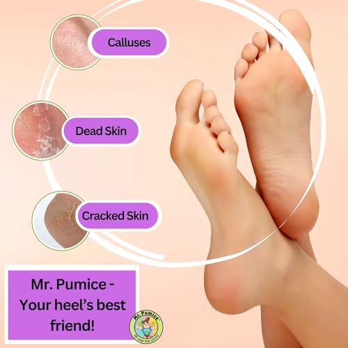 Mr. Pumice Mr. pumice purple pumi bar, extra-coarse callus remover, pedicure stone & ped file scrubber for smooth feet and heels, 6 Count