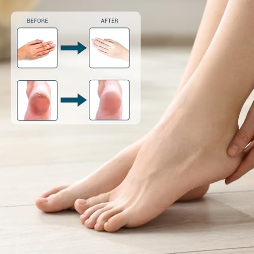 960 Count Paraffin Wax Bags - 12" x 17" Disposable Liners for Hand & Foot Treatments
