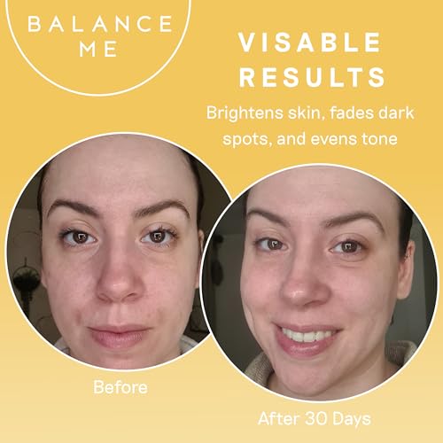 Balance Me Vitamin C Repair Serum, With Hyaluronic Acid, Reduce Age Spots & Hyperpigmentation, Anti-Ageing & Hydrating?Face Serum?? 100% Natural, Vegan & Cruelty Free, Made?in?UK, 1.01 Fl Oz