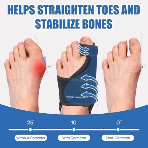 Bunion Corrector with Aluminum Bar – Day & Night Support for Men & Women
