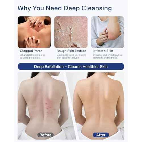 Yiclick Exfoliating Washcloth Towel with Handle, Shower Puff Back Scrubber for Shower, Exfoliating Body Scrubber Exfoliator, Bath Sponge Loofah Luffa Washer Exfoliator