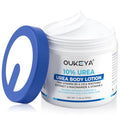 OUKEYA 10% Urea Body Lotion for Dry Skin - 11.28 oz Moisturizer