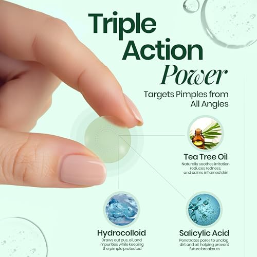 Zit Zap Pimple Patches-Hydrocolloid Acne Spot Patch- 4 Sizes-360 Count. (8mm 10mm 12mm 14mm, 360, Count)