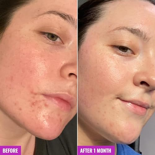 Good Molecules Clarify and Cleanse Bar Pack 2 ? 89 g / 3.15 oz Each | Soap Free Face & Body Cleansing Bar with Salicylic Acid (BHA)