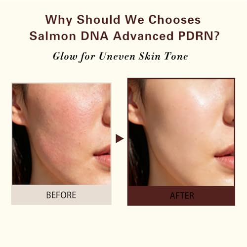 Advanced PDRN Rejuvenating Cream, 99% Pure Salmon DNA Collagen Gel Repair Cream, 0.7 oz, with Hyaluronic Acid and Niacinamide, Nighttime Skin Repair,Inspired Skincare