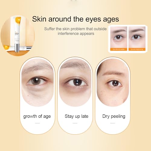 Ojeras Tratamiento Para Mujer, Vitamin c Eye Cream, Eye Tightener Cream for Under Eye Bags, Skin Renewing Anti Aging Eye Cream, Under Eye Cream for Women Mens (40g Crema para Las Ojeras Oscuras Mujer)