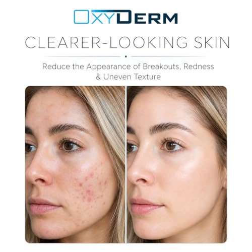OxyDerm Acne Spot Treatment - Fast-Acting Invisible Formula