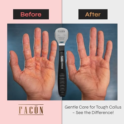 Professional Callus Shaver with 50 Blades - Surgical-Grade Tool for Feet & Hands