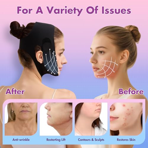 Mr.Jing Black Face Slimming Strap for V-Line Lift & Double Chin Reduction, Medium