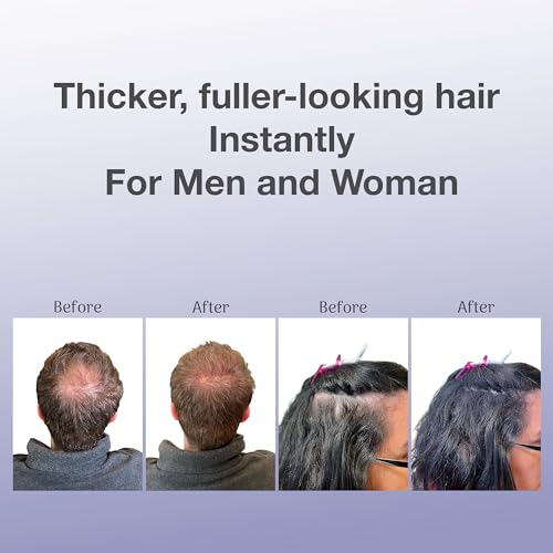 BosleyMD BOSVolumize Hair Thickening Fibers – Dark Brown