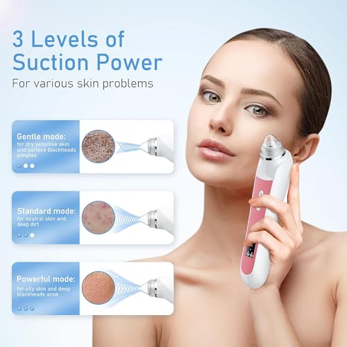 Blackhead Remover Vacuum with HD Camera & 6 Suction Heads