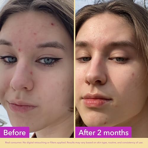 Good Molecules Niacinamide 10% Serum - Pore Minimizer