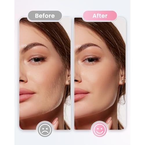Dermaplane Razor For Women Face, 3 Adjustable Dermaplaning Tool, Facial Hair Removal Razors with Led Light for Peach Fuzz,Rechargeable Sonicsmooth Facial Hair Remover with 8 Replacement Blades (White)