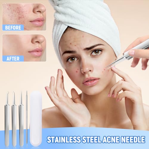 Jurfest 7-Piece Stainless Steel Blackhead Removal Kit
