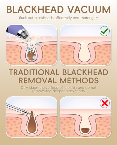 Pore Vacuum Blackhead Remover - 5 Attachments & 3 Suction Levels