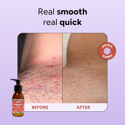 Ingrowns Out Exfoliating Scrub for Bikini & Underarms