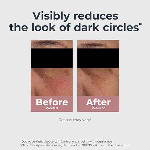 Eucerin Radiant Tone Eye Cream Dark Circle Corrector, Eye Brightening Cream with Thiamidol and Hyaluronic Acid, Helps Reduce the Look of Eye Puffiness, 0.5 Oz Tube