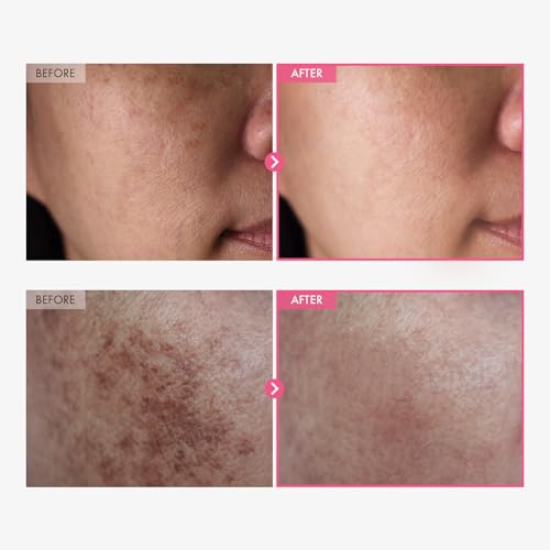 TOSOWOONG K-Beauty Tone-Refining Duo: Arbutin 7 Tranexamic Acid 4 Cream and Pink Peptide 12 PDRN Serum | Trending Ingredients for Uneven Skin Tone & Texture | Tone-Refining and Firming Moisturizer Set