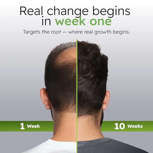 Alphainfuse Hair Serum for Men - Ginseng & Eclipta Scalp Care