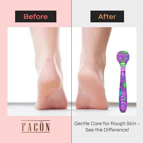 Fac?n Professional Callus Shaver Remover with 50 Blades, Pedicure Razor for Feet & Hands, Foot Razor for Callus Removal, Callus Blade Remover, Corn Shaver, Surgical Grade Premium Stainless Steel Tool