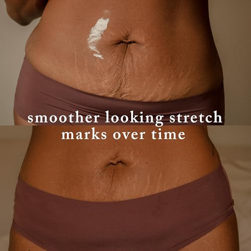 Nemah Stretch Mark Cream for Pregnancy | Belly, Hips & Thighs