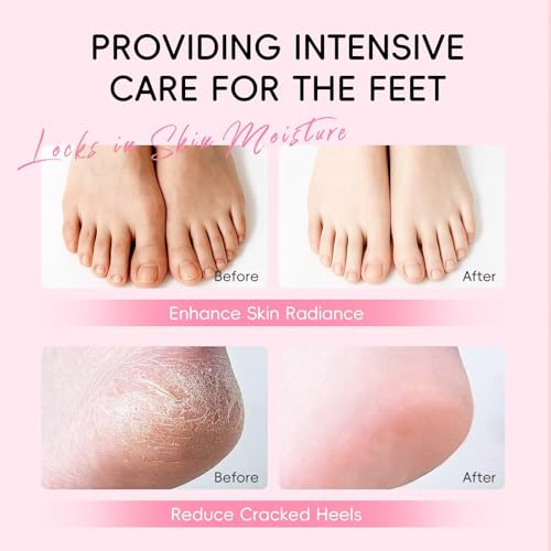 Sakura Heel Balm Stick for Cracked Feet & Dry Skin