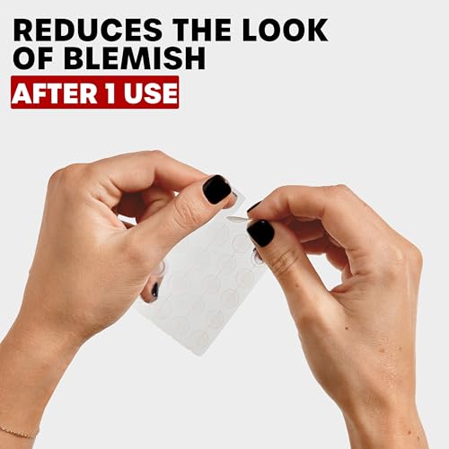 THAYERS Invisible S.O.S Hydrocolloid Acne Pimple Patch, Ultra-Thin Design Instantly Reduces Look of Blemishes, Set of 22 Pimple Patches
