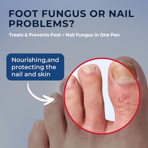 FSA/HSA Toenail Fungus Treatment Pen 25% Undecylenic Acid
