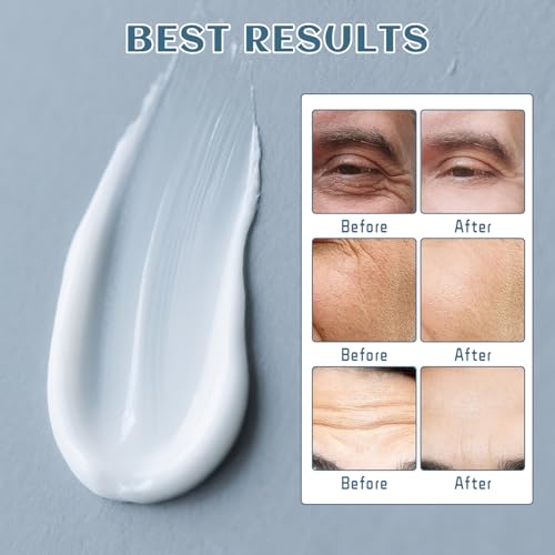6-in-1 Face Cream for Men with Retinol, Hyaluronic Acid, Niacinamide & Caffeine, Face & Neck Moisturizer for Mens Anti-Aging, Retinol Cream for Face Dark Circle, Wrinkles and Puffiness, 1.7 oz