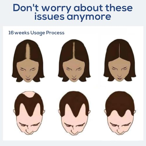 Laser Hair Growth Comb - Low Level Laser Therapy Scalp Device (7 Diodes)