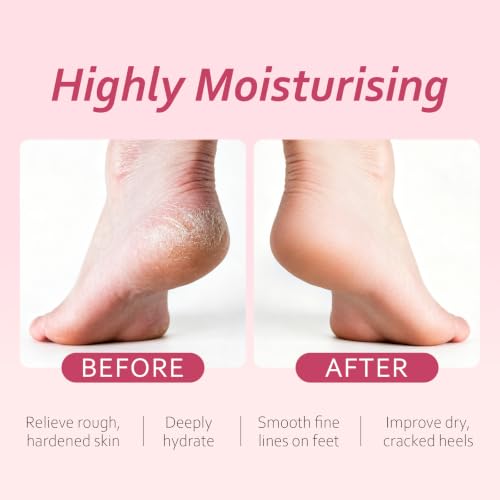 KOSRA Japan Sakura Foot Heel Stick Moisturizer for Dry Cracked Skin 40g