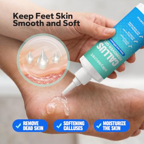 SilkySecret Callus Remover Gel for Feet - Extra Strength Foot Softening & Cracked Heel Treatment