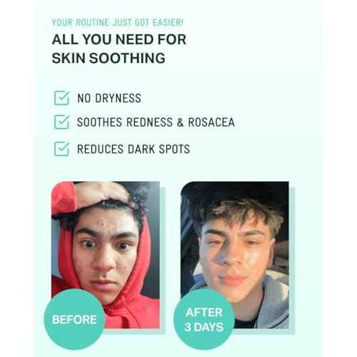 BRING GREEN ZINC TECA Serum with Niacinamide | Soothing Face Serum for Sensitive Skin, Pore Minimizing & Hydrating | Korean Skincare for Breakouts & Uneven Texture