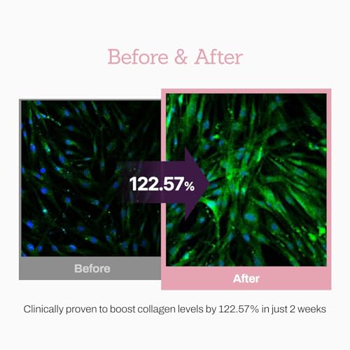 Collagen Peptide 12X Boosting Serum, Enhances Skin Elasticity & Reduces Deep Wrinkles, Promotes Collagen Production for Firm and Youthful Skin, Korean Skincare, 1.01 fl.oz