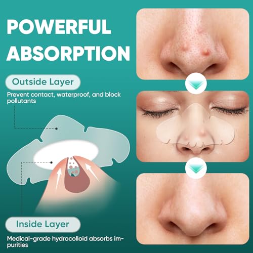 Unscented Hydrocolloid Nose Pore Patches 30 Count - Overnight Blackhead Remover