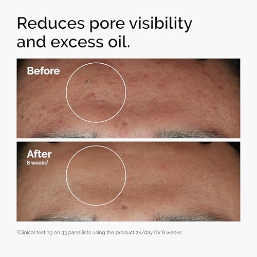 The Ordinary Skin Care Set with Serums for Hydrating Brightening & Pore-Minimizing