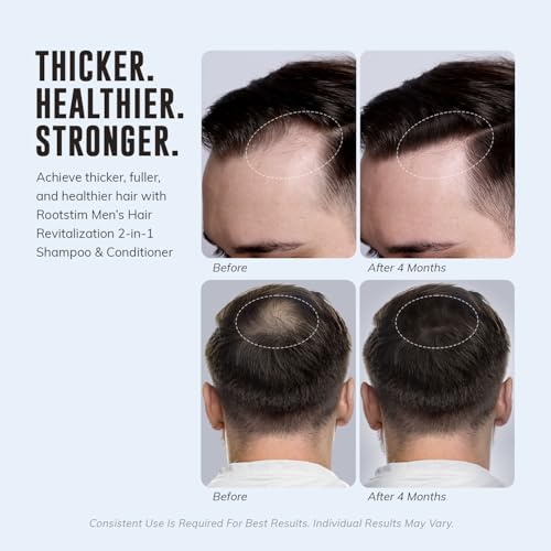 DHT Blocking Shampoo for Men - Hair Thickening & Growth 10oz