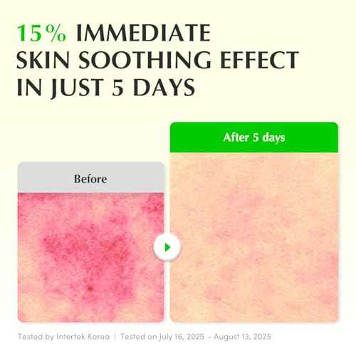 EQQUALBERRY Aloe PDRN Calming Smoothie Serum ? Soothing Korean Skin Care for Sensitive Skin, Cica & Aloe for Repair, Hydrating & Radiant Glow, Non-Comedogenic (1.01oz / 30ml)