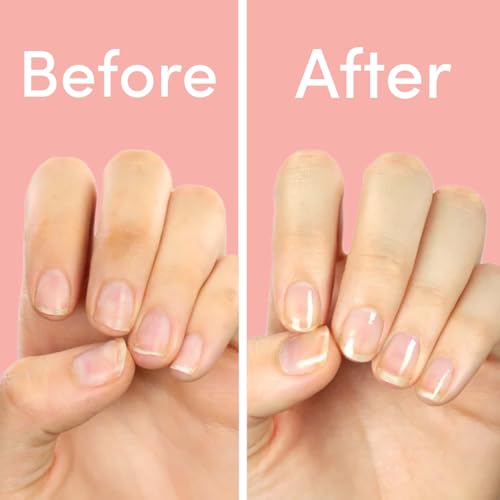 ella+mila First Aid Kiss Nail Strengthener & Hardener