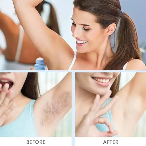 Bettenko Ingrown Hair Serum for Smooth, Clear Skin - Gentle & Fast-Absorbing