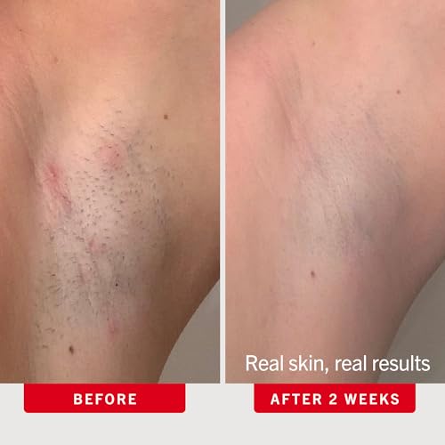 First Aid Beauty Ingrown Hair Pads for Razor Bumps & Exfoliation