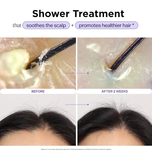 Dr. Groot Hair Loss Treatment Rinse | 5-Second Scalp Care
