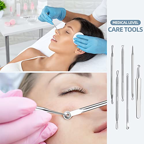 JPNK Silver Blackhead Remover Kit - Comedone Extractor for Acne & Blemishes