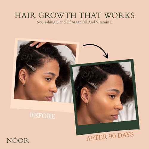 NOOR HAIR Growth Serum From African Olives, for Women and Hair Loss Treatment for Frizzy and Damaged, For Thicker and Healthier- Natural Vitamins Argan Oil