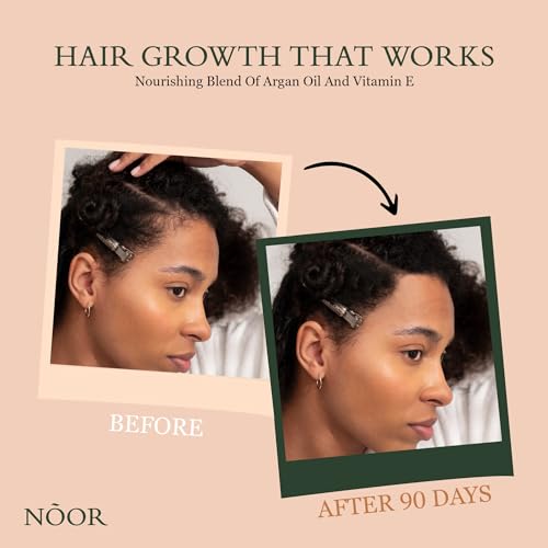 NOOR Hair Growth Serum with Argan Oil for Hair Loss